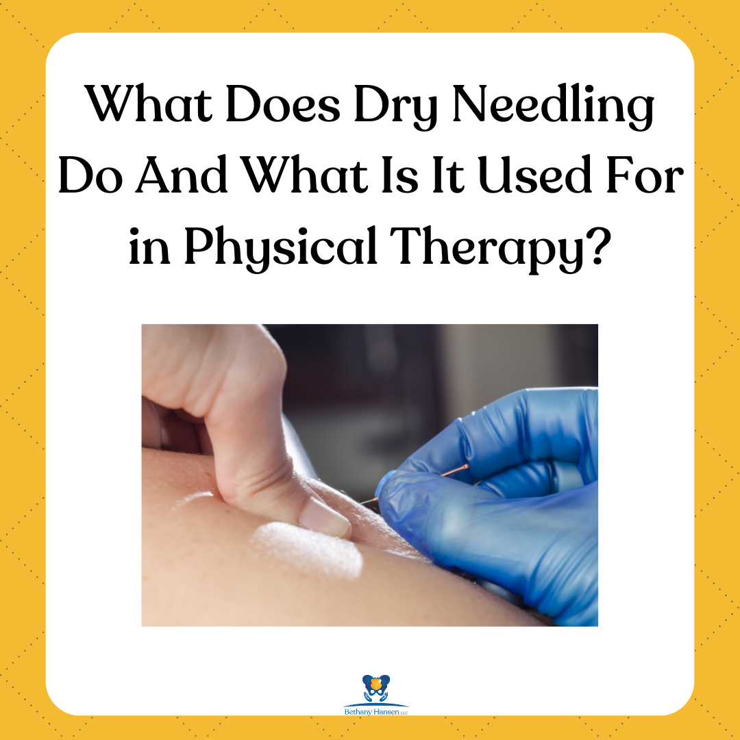 What Does Dry Needling Do?